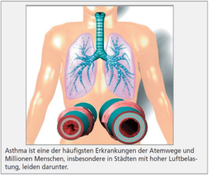 Mikronährstoff-Synergie bei Asthma